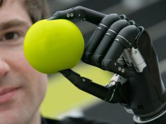 I-limb-technology